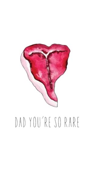 You're So Rare Image